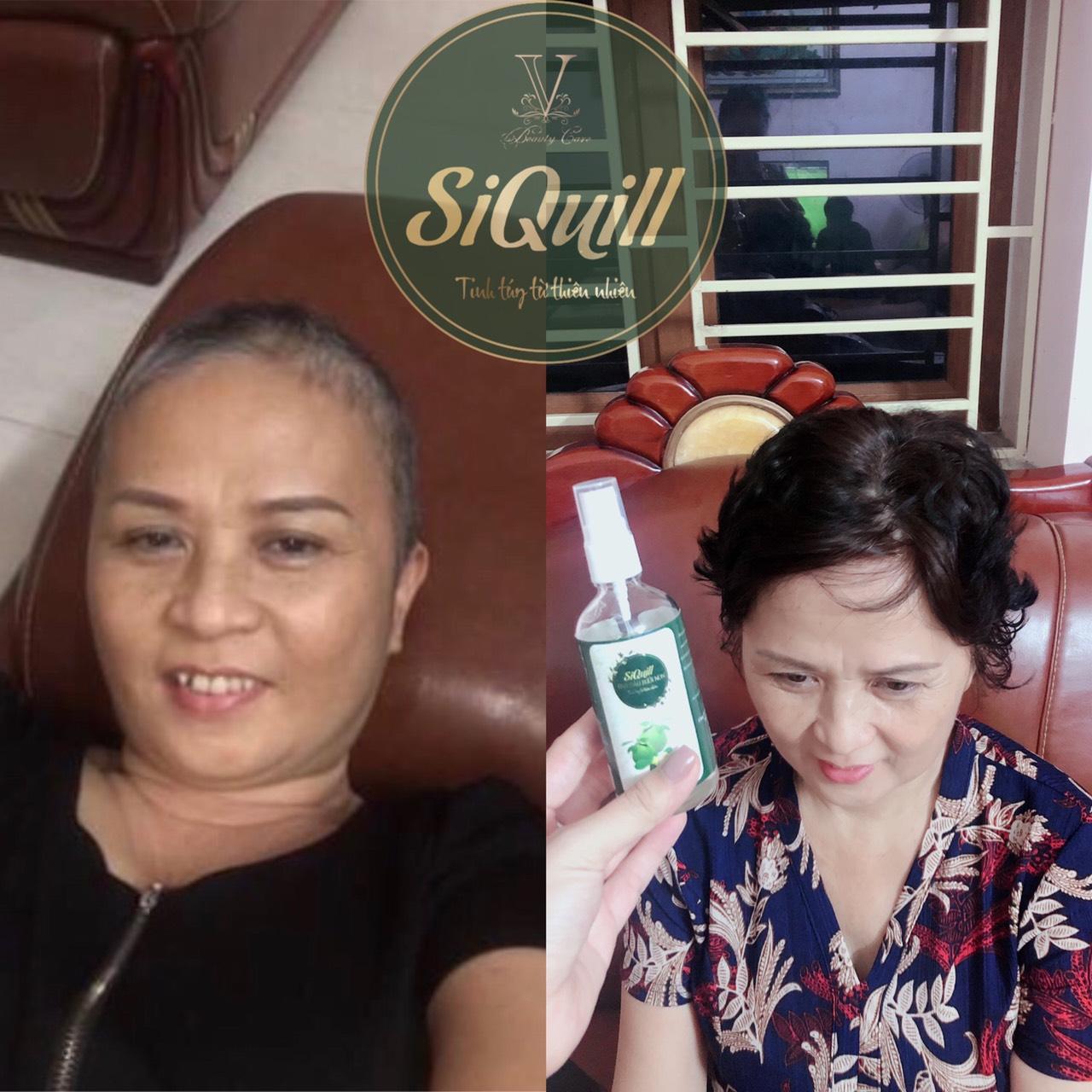 Combo TRỊ RỤNG TÓC - CHĂM SÓC TÓC - KÈM QUÀ TẶNG