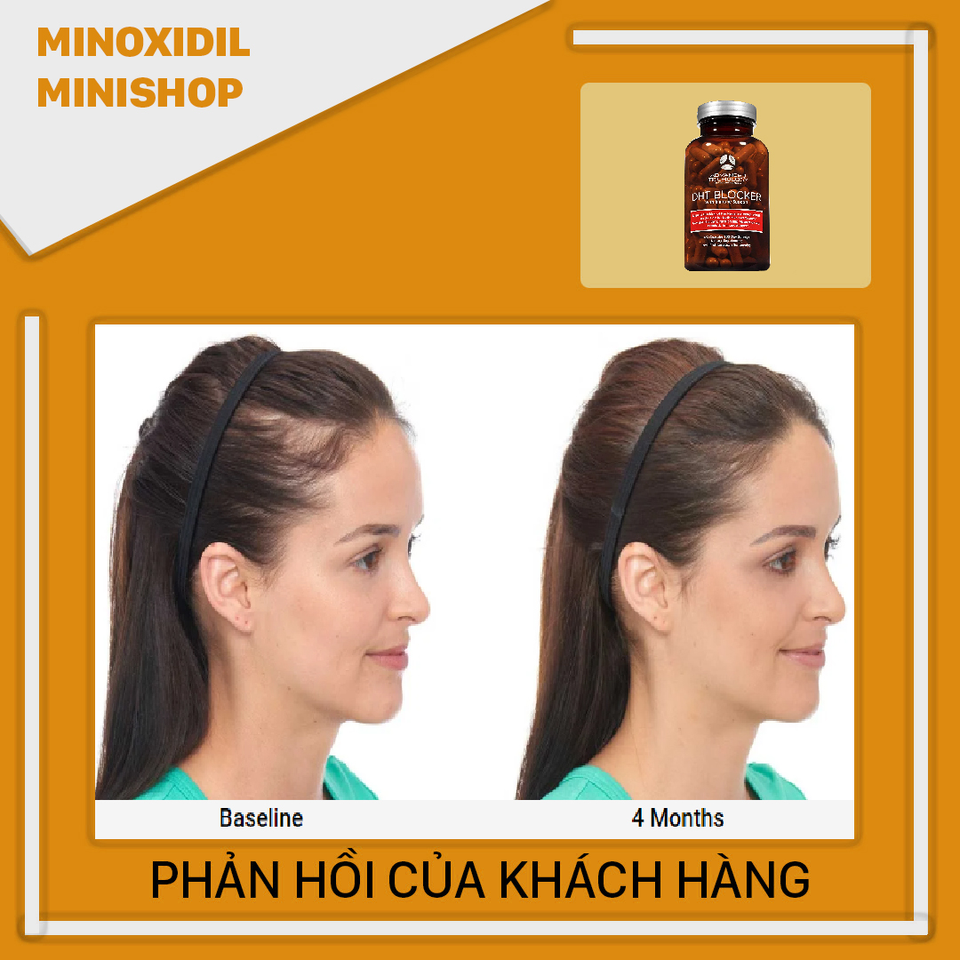 Advanced DHT Blocker chống rụng tóc