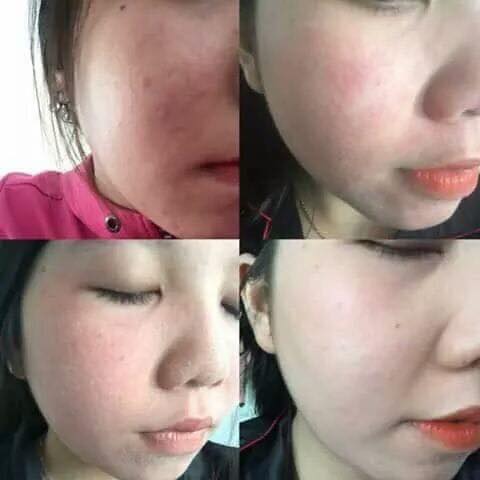 Kem đông y tái tạo da handmade
