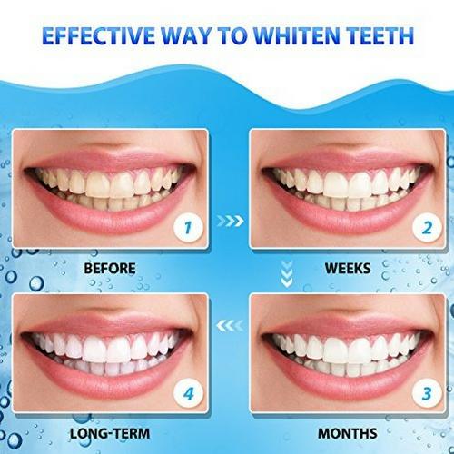 [HCM] [HỘP FULLBOX 10 GÓI] Miếng dán trắng răng Crest 3D White 1 hour - Mỹ