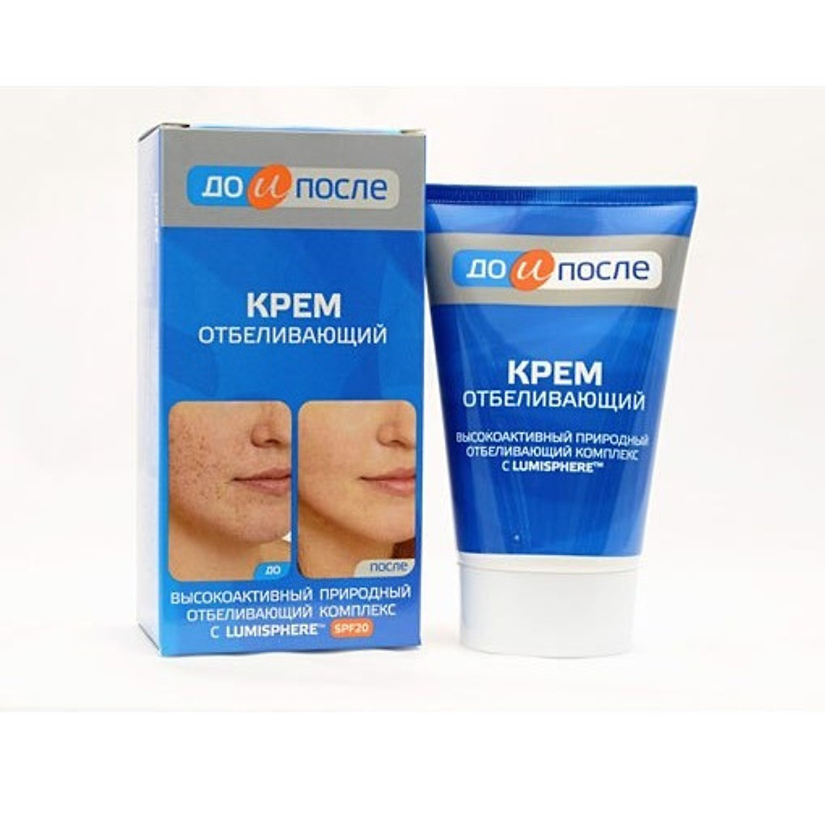 Kem mờ thâm nám và tàn nhang Kpem Nga 100ml