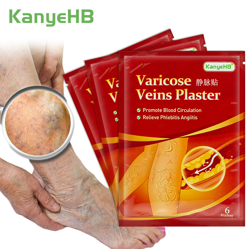 Miếng dán giãn tĩnh mạch kanyehb thúc đẩy lưu thông máu, giảm giãn tĩnh mạch, đau tĩnh mạch, tĩnh mạch mạng nhện