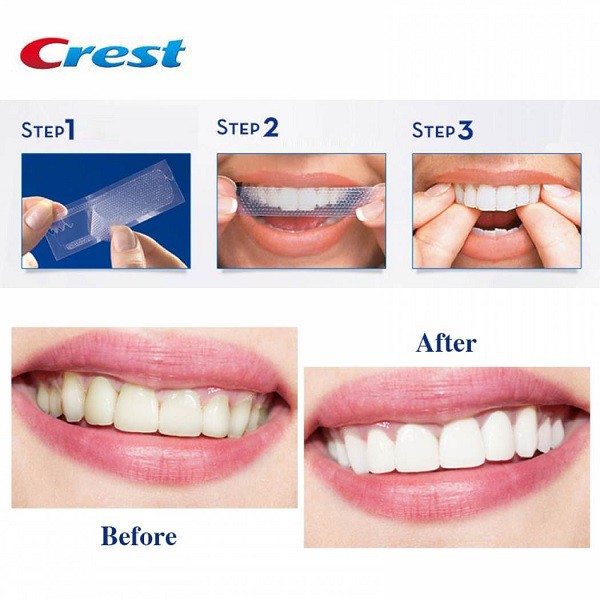 Miếng Dán Trắng Răng Crest 3D Professional Effect 20 GÓI - FULLBOX