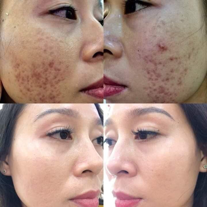 cao tinh nghệ sữa ong chúa  Thảo mộc 37