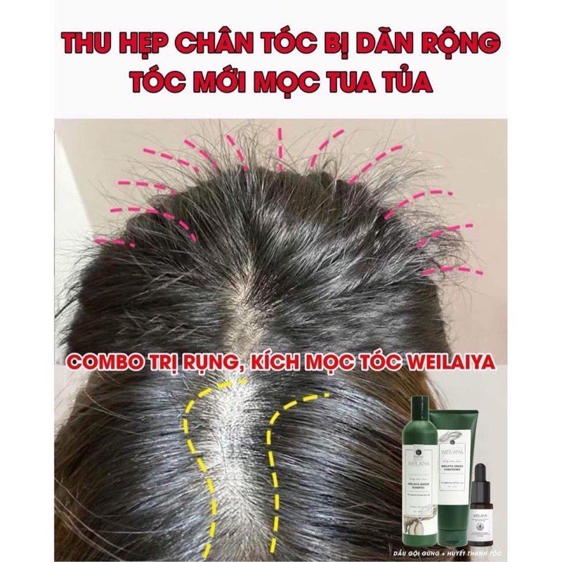 Huyết thanh Weilaiya kích thích mọc tóc, ngăn rụng tóc