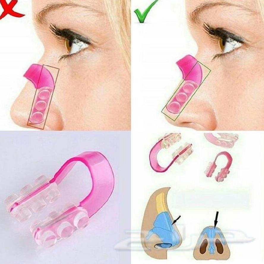 Kẹp Nâng Mũi Nose Up VW01