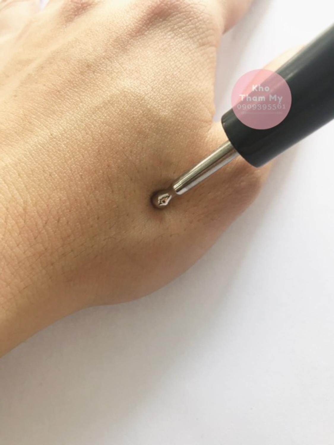 Dùi Inox (Cây dò huyệt trên lưng) - Dụng cụ diện chẩn