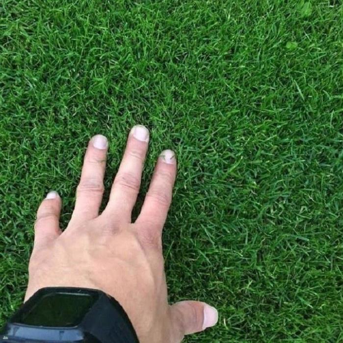 Nấm Đối Kháng Trichoderma Điền Trang Gói 1 Kg