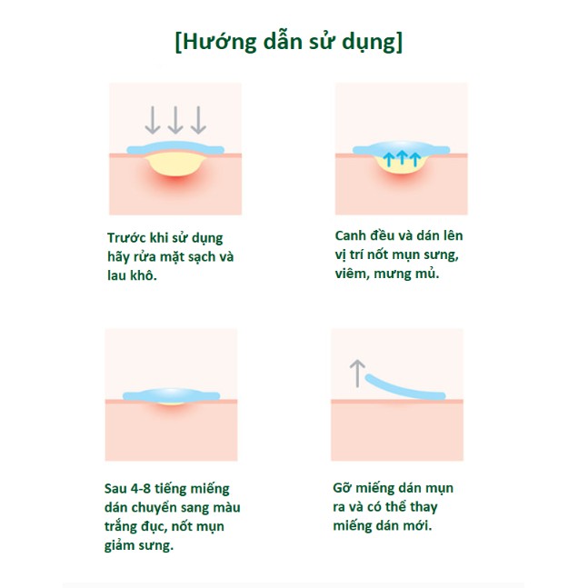Miếng Dán Hỗ Trợ Giảm Mụn "Thần Kỳ' Some By Mi Clear Spot Patch (Set 18 miếng)