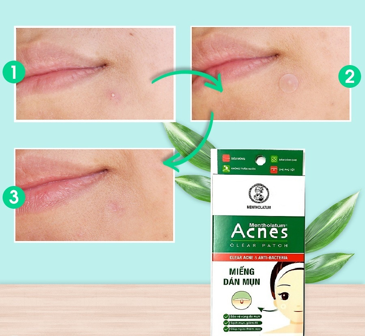 Miếng Dán Mụn Acnes Clear Patch (224 miếng)