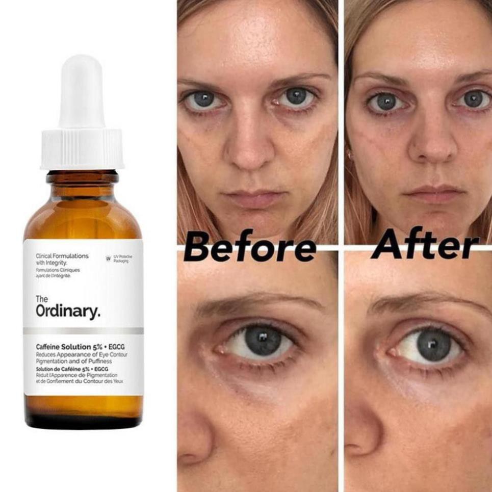 Tinh Chất The Ordinary Caffeine Solution 5% + EGCG ( 30mL )