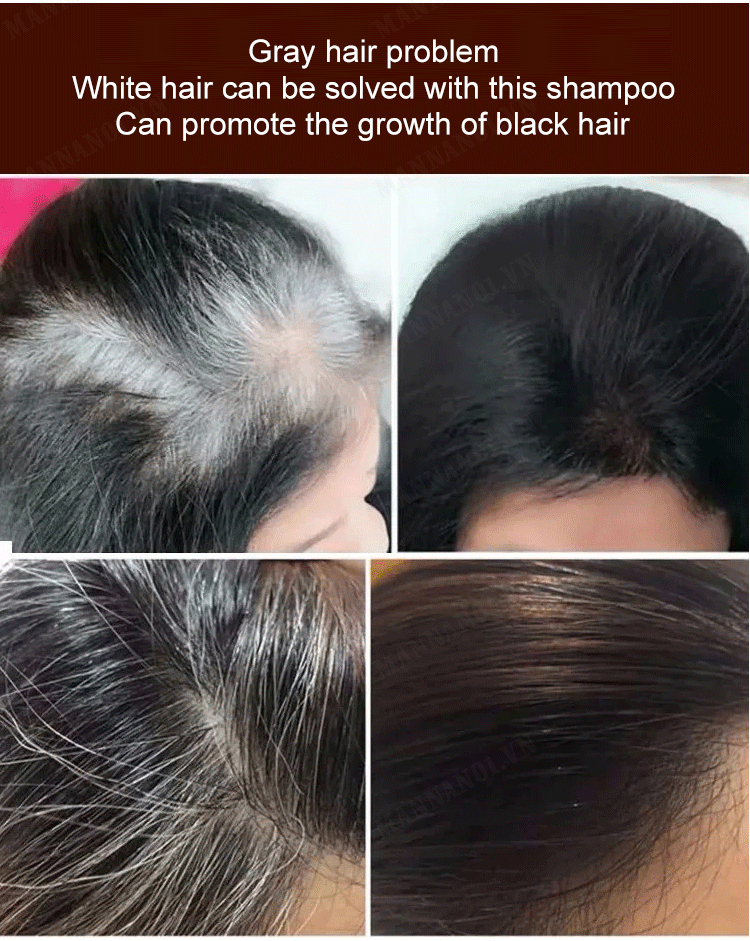 mannan01 Black Ganoderma Polygonum Shampoo 1000ml + 400ml