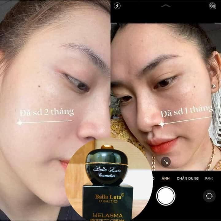 FACE VIP Mẫu  Mới Balla Luta Dưỡng Trắng Da
