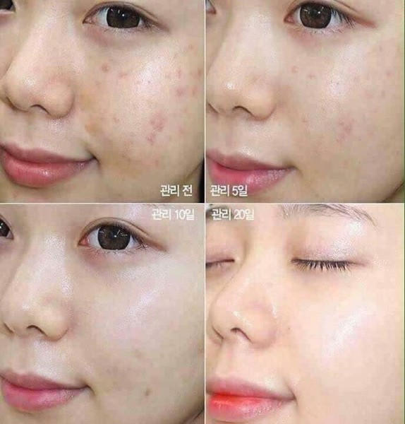 Tinh chất rau má Skin1004 Madagascar Centella Ampoule - 55ml