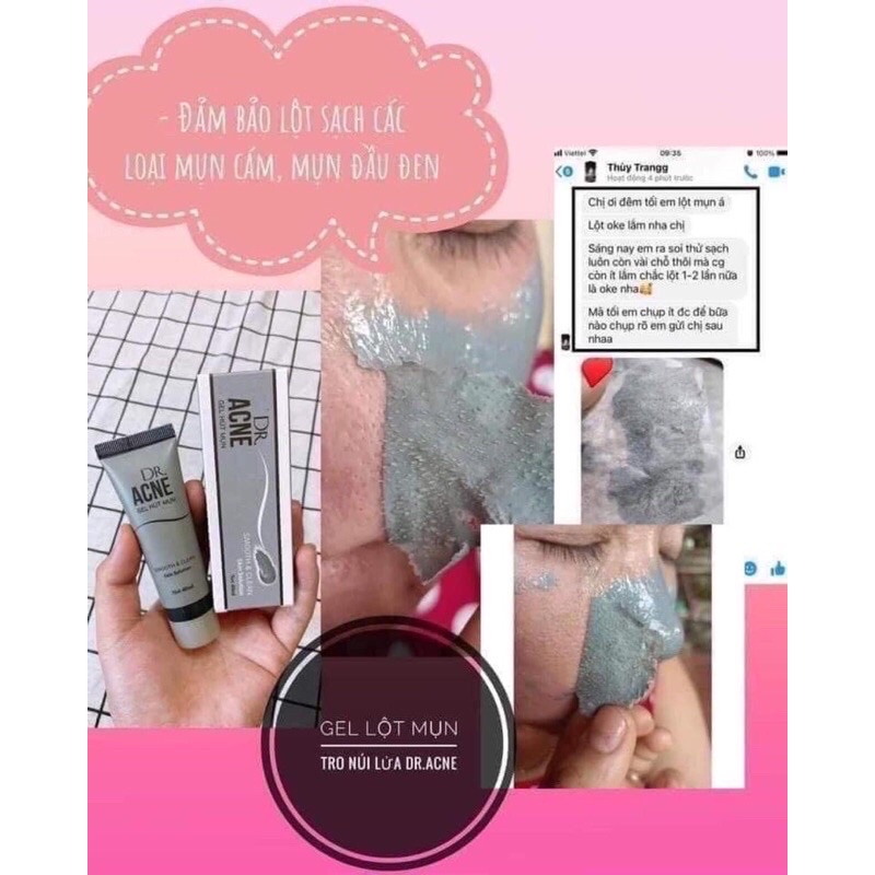[Chính Hãng] gel lột mụn dr acne