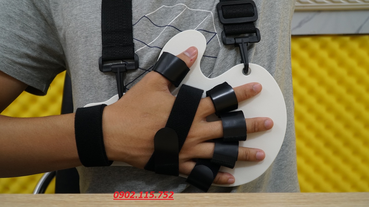 NẸP CỐ ĐỊNH BÀN NGÓN TAY