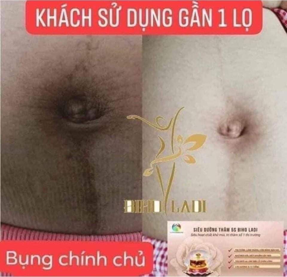 [HCM][HÀNG CHÍNH HÃNG] Kem Siêu Dưỡng Thâm 5S Biho Ladi