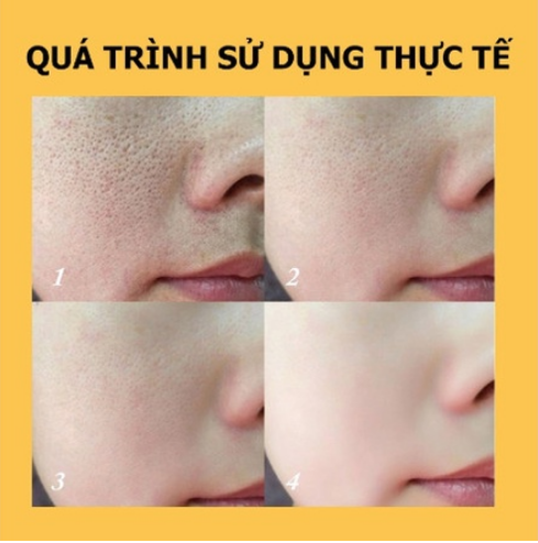 Serum sáng da mờ thâm Vitamin C 30ML SUZIKO
