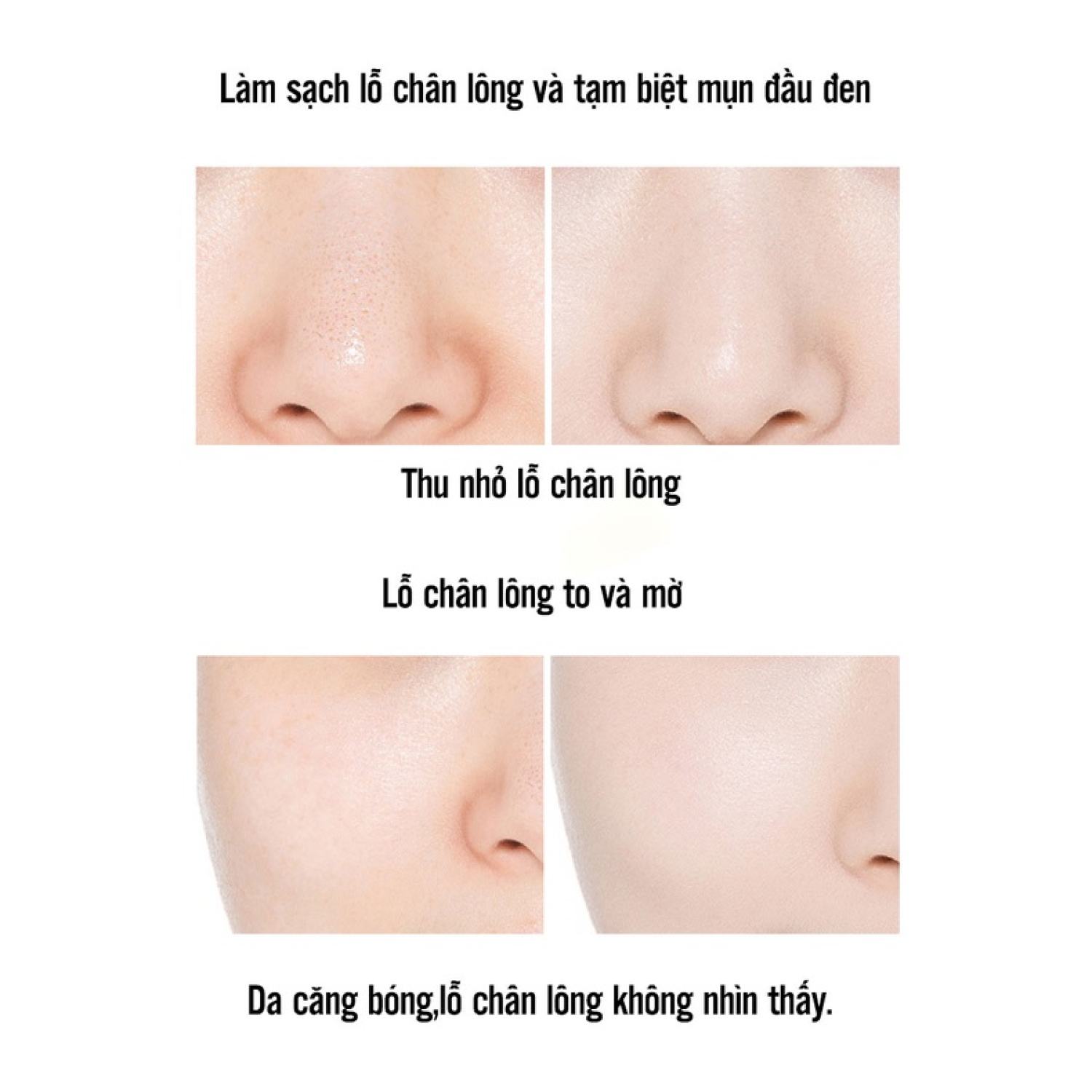 [ SIÊU HOT ] Kem Dưỡng Vitamin E HCHANA Sáng Da Cấp Ẩm