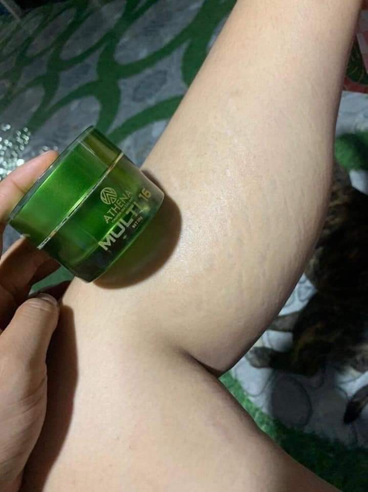 [100% CHÍNH HÃNG ] Kem Rạn Da Multi 16 - Làm Mờ Rạn Da Sau Sinh Và Rạn Da Do Tăng Cân (20g)