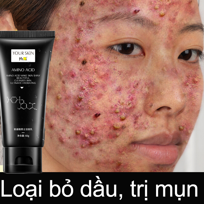 [bday free shipping]Sữa rửa mặt dành cho nam giới axit amin nhẹ nhàng không kích ứng làm mịn da làm sạch dầu bóng nhờn làm trắng da loại bỏ mụn đầu đen bọt mềm mịn ức chế mọc mụn dùng cho cả da mẫn cảm