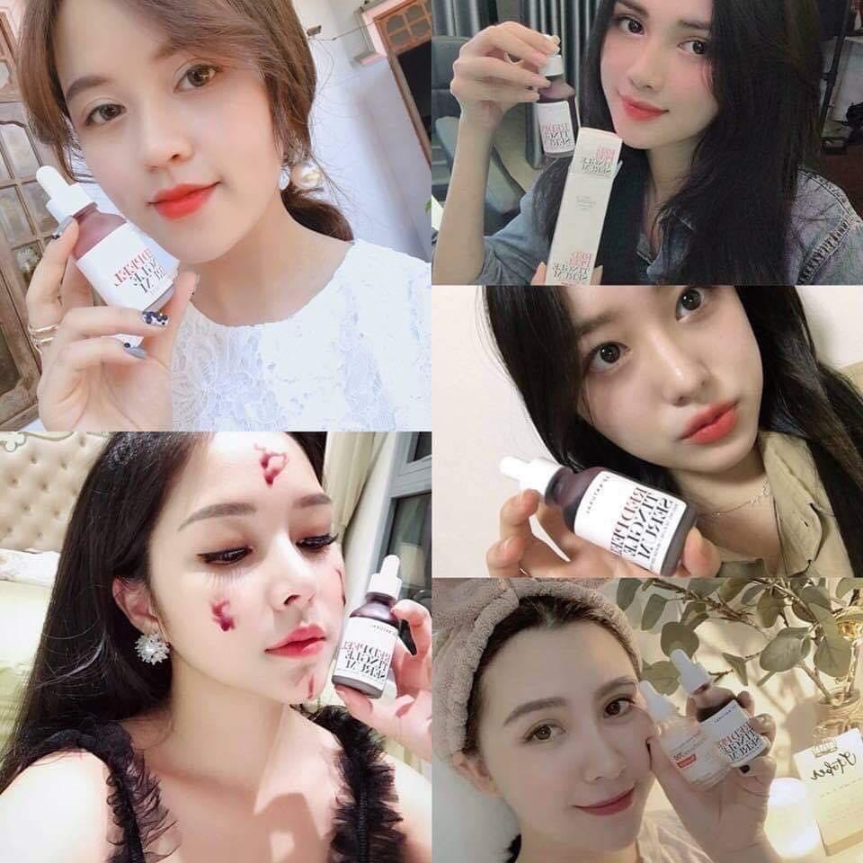 Serum Red Peel Tingle Thay Da Phục Hồi Sinh Học 35ml