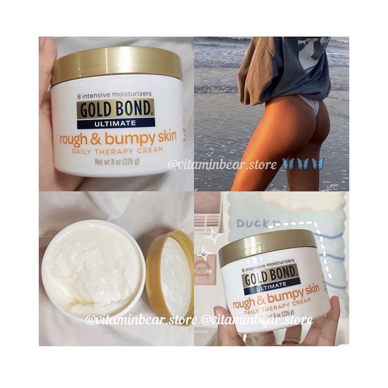 [Vitaminbear] Kem dưỡng body gold bond rough and bumpy skin