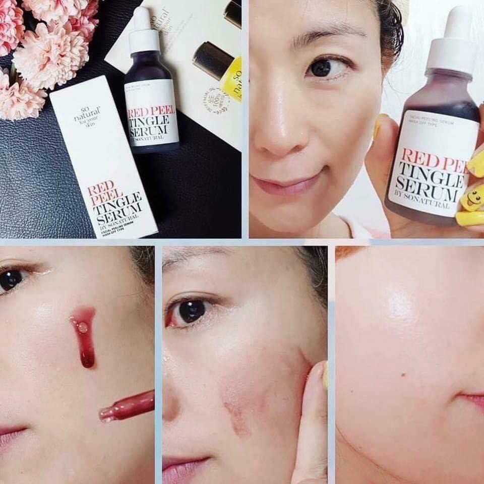 Serum Red Peel Tingle Thay Da Phục Hồi Sinh Học 35ml
