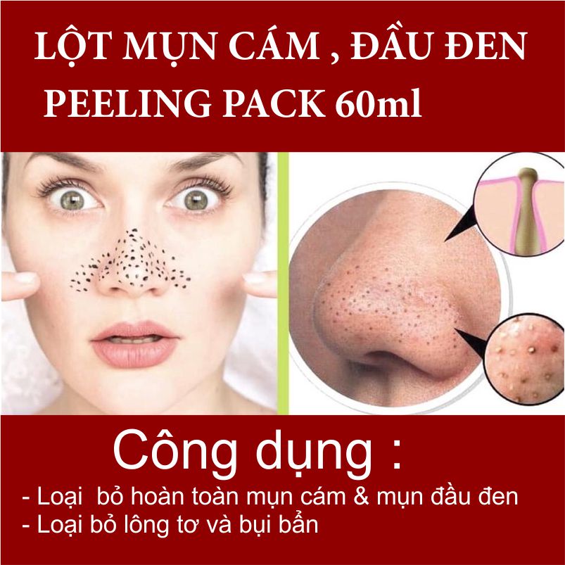 Kem lột mụn cám, mụn đầu đen PEELING PACK