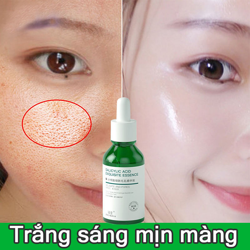 serum trắng da se lỗ chân lông serum tinh chất làm nhỏ lỗ chân lông 30ml