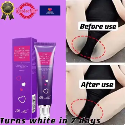 [HCM]PEIMEI Private Part Whitening Cream Removing Melanin Whitening Bikini Whitening Cream Underarm Whitening Pink Essence Whitening Cream For Lip Areolas And Private Parts Intense Cream Remove Skin Melanin Knee Care Inner Thigh (30g)