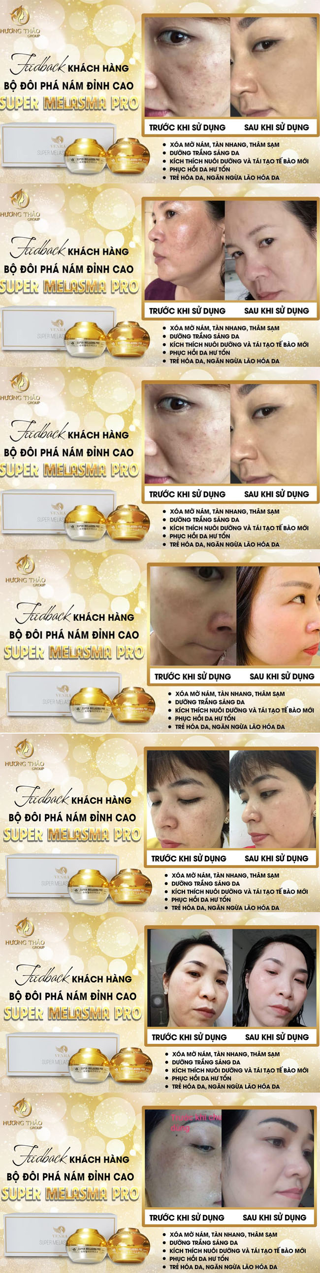 Bộ Đôi Phá Nám Đỉnh Cao Super Melasma Pro