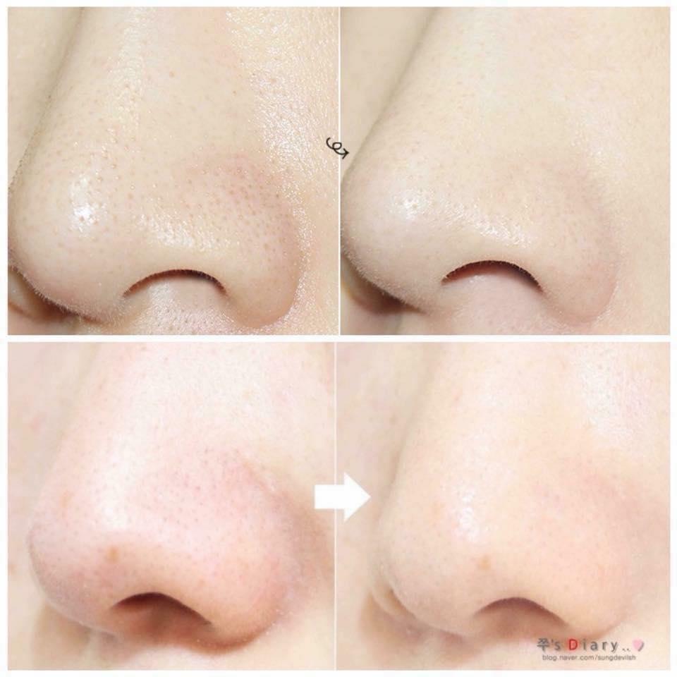 [HCM]Thanh Lăn Mụn Đầu Đen Mamonde Pore Clean Blackhead Stick