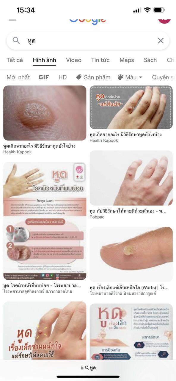 Chấm mụn cơm mụn cóc ConCon Thailand