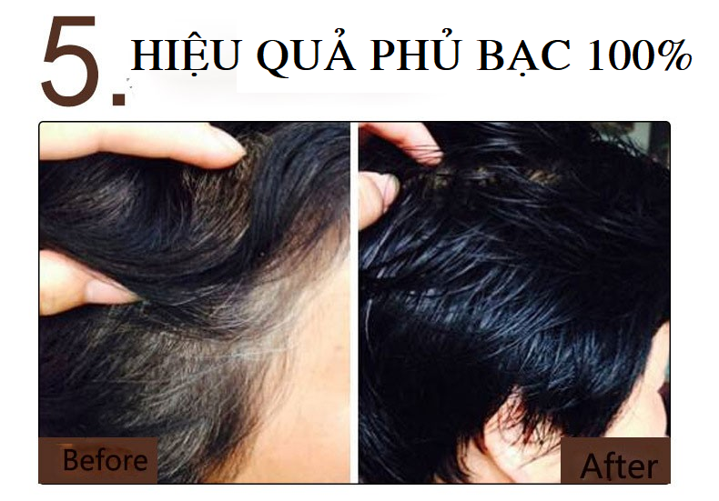 Gội Nhuộm Đen Tóc MEIDU