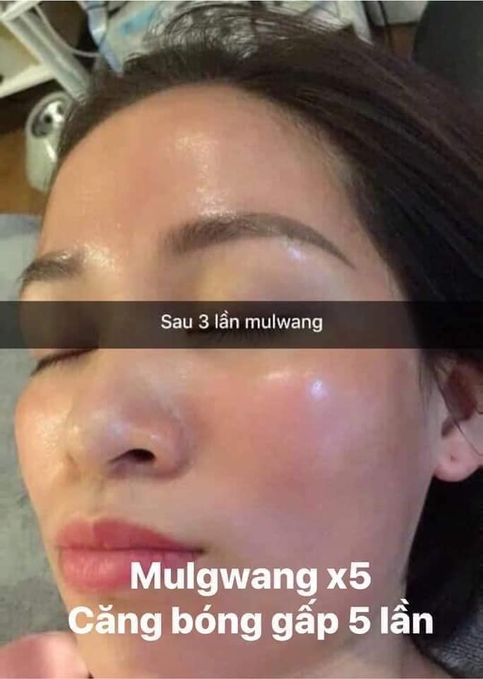 Tinh chất căng bóng Mulwang x5 Hàn Quốc