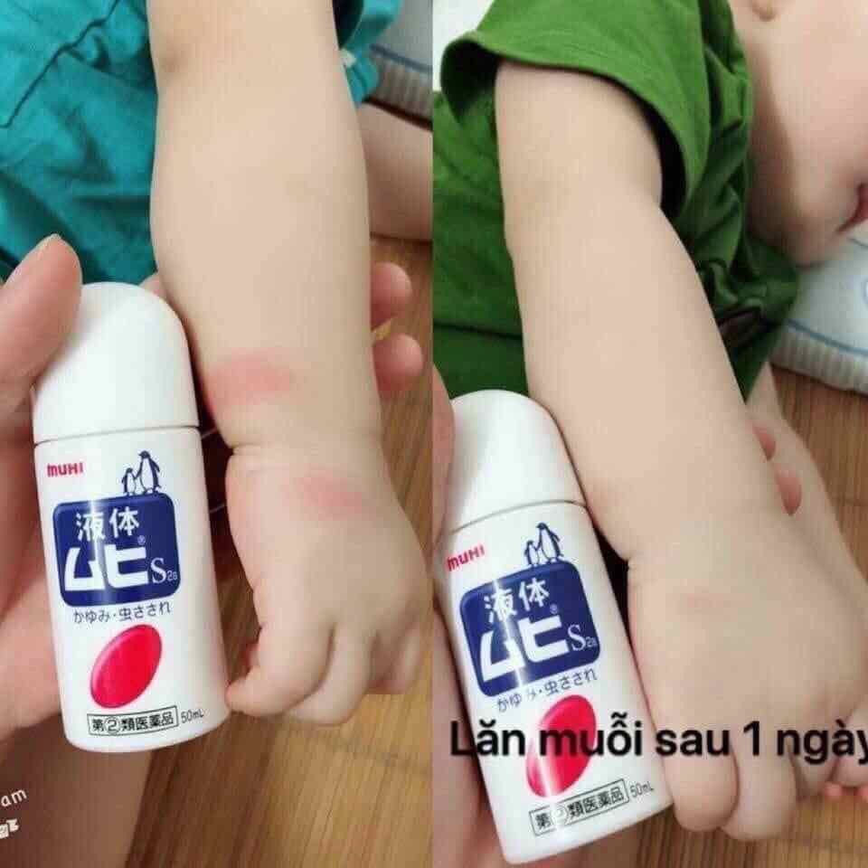 [6M+] Lăn Muỗi Và Côn Trùng Cắn Muhi