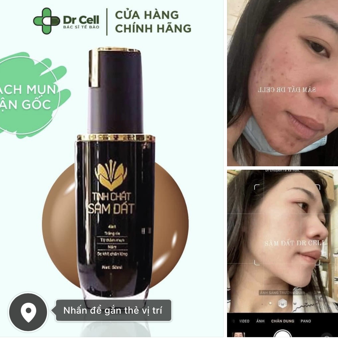 Tinh Chất Sâm Đất Dr Cell Giảm Mụn, Thâm, Nám, Se Khít Lỗ Chân Lông 50ml