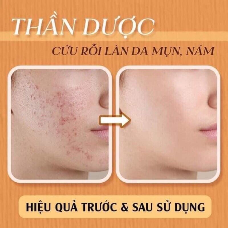 Serum Cốt Thảo Dược 36 Vị - Meea Organic 10ml