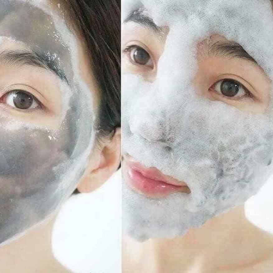 Combo 10 Mặt nạ thải độc sum: 37 Black Award Bubble-De Mask