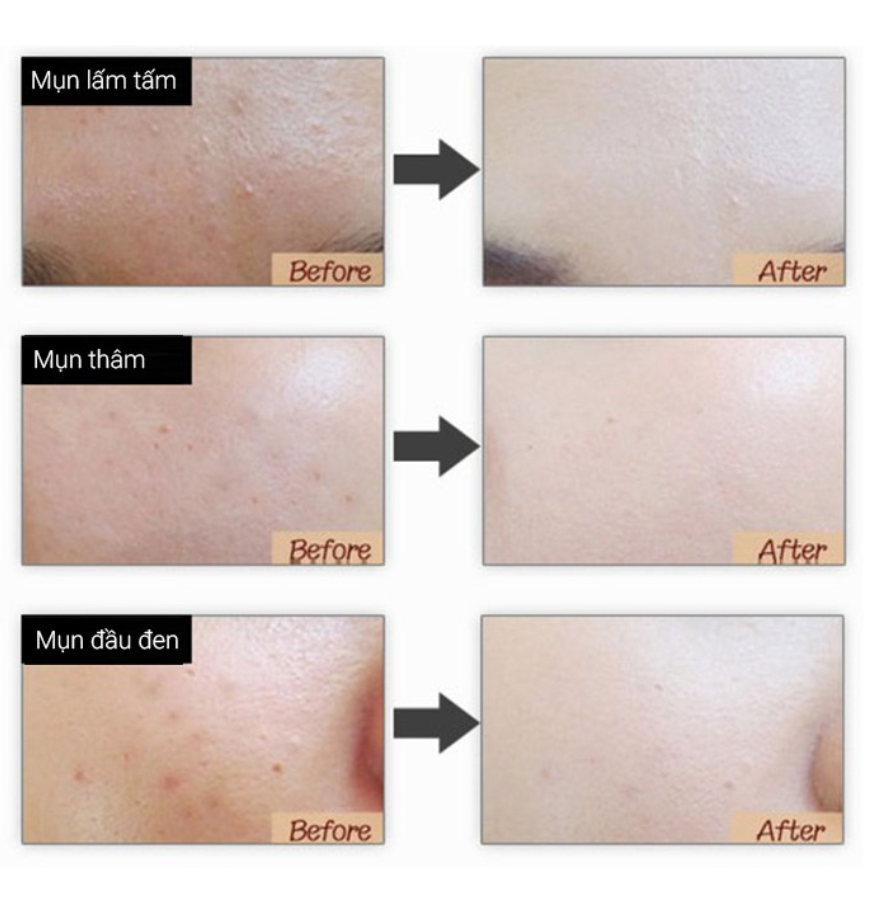 Kem nền che khuyết điểm BB Cream AGC