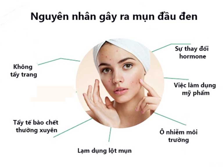 [HCM]Gel hút mụn trà xanh OHIO