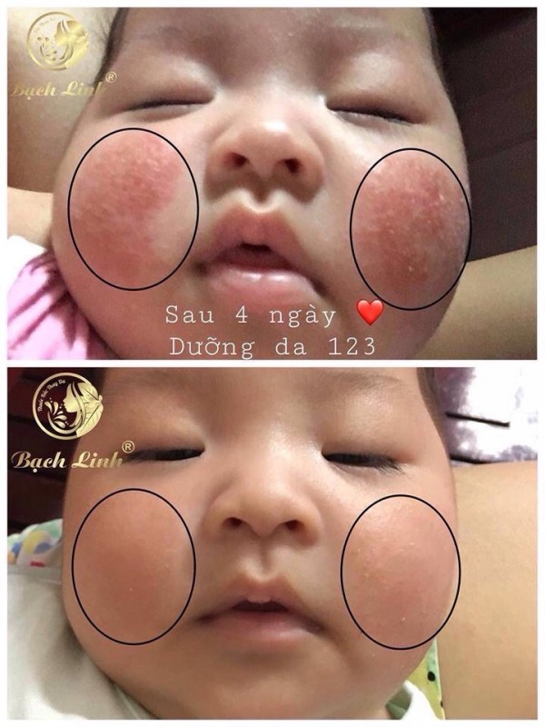 [Sẵn hàng] Dưỡng da 123 Bách Y Sâm tái tạo phục hồi da 40ml