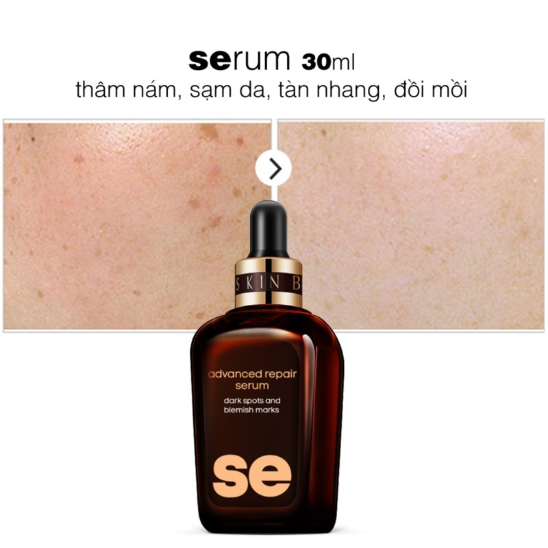 SErum THÂM NÁM, SẠM DA, TÀN NHANG, ĐỒI MỒI 30ml LANGCE