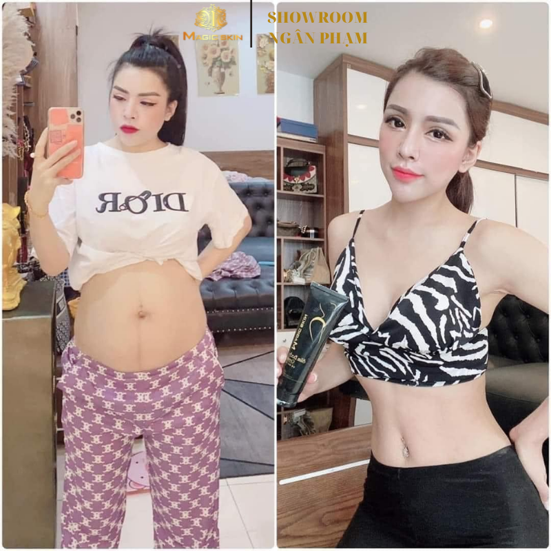 Kem tan mỡ Slim Body Cream,tan mỡ bụng gừng quế - Magic Skin