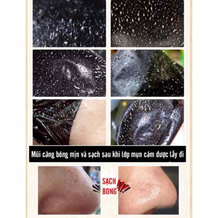 Bộ 2 lột mụn than tre lê thanh lột sạch tận gốc mụn đầu đen mụn cám