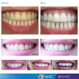 [Hàng Mỹ] Combo 10 miếng (5 gói/5 ngày) dán trắng răng Crest 3D White Whitestrips Professional Effects (mẫu mới 2023)