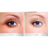 Kem chống thâm quầng mắt Naris Wrinkle Plus Eye Zone Bright Cao cấp Nhật Bản 20g