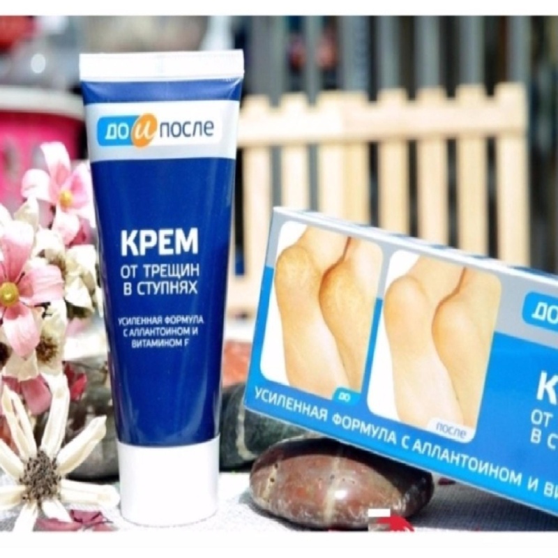 Kem Đặc Trị Nứt Gót Chân Hiệu Quả Kpem Apteka Của Nga 50ml