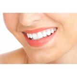 Kem Đánh Răng Colgate Max Fresh Breath Strips Cool Mint - 206g.